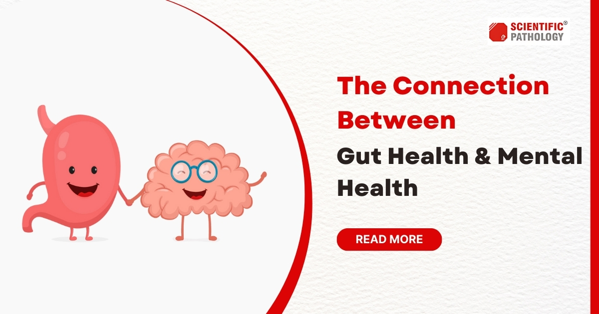 The Connection Between Gut Health & Mental Health