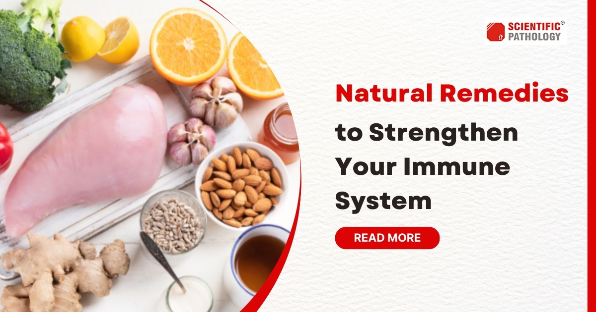 Natural Remedies to Strengthen Your Immune System