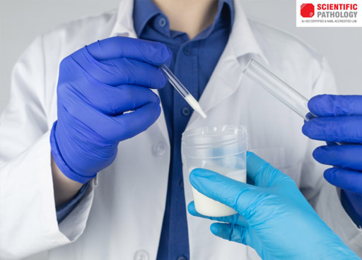 Best Technology for Sperm Analysis Testing – Scientificpathology.com